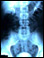 Kidney X-ray