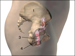 Anterior vaginal wall repair