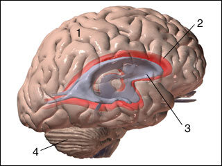 Normal pressure hydrocephalus