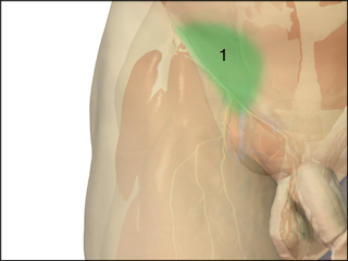 Site of inguinal hernia