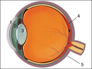 Retinitis