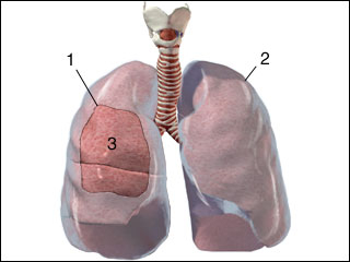 The lining of the chest cavity (pleura)
