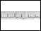 Electrocardiogram of Wolff-Parkinson-White syndrome