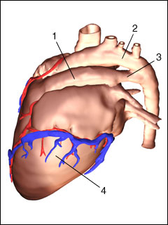 Patent ductus arteriosus