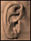 Ear polyps