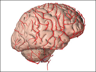 Site of cerebral arteriography