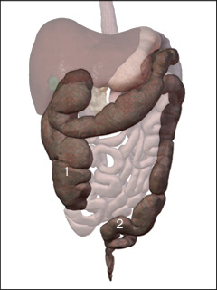 Site of barium enema