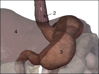 Hole in the esophagus