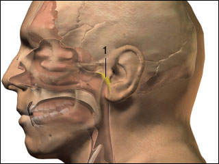 Enlarged adenoid