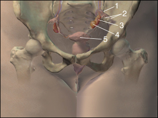 Ovarian cysts