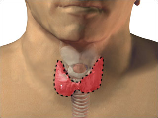 Thyroid gland removal