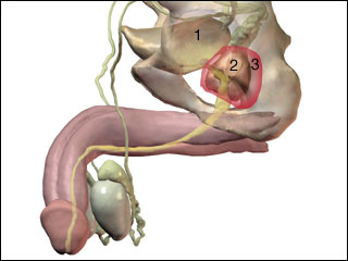 Prostatitis; acute