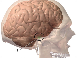 Cavernous sinus