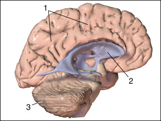Cranial MRI