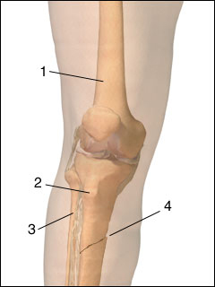 Fracture of the leg