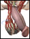 Testicular torsion 