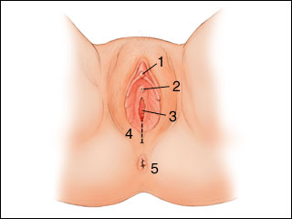 Episiotomy