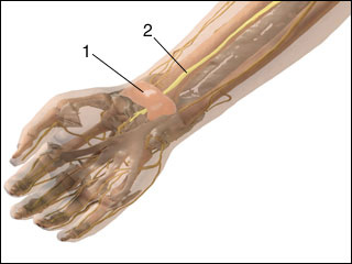 Median nerve