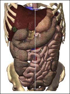 Inflammation of the sac that lines the abdominal cavity (peritoneum)