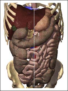 Inflammation of the sac that lines the abdominal cavity (peritoneum