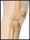 Lateral collateral ligament (LCL)