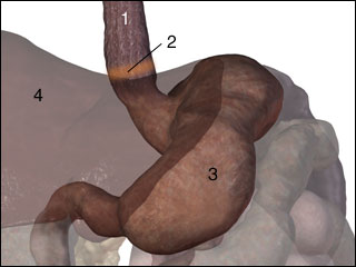 Lower oesophageal ring