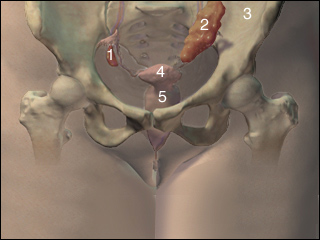 Polycystic ovary syndrome