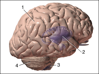 Damage to basal ganglia