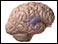 Damage to basal ganglia