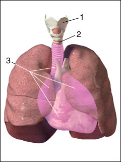 Mediastinal emphysema