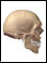 Inflammation of the mastoid process and mastoid sinuses