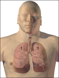 Pneumonia