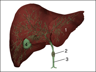 Obstruction of the bile duct