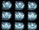 Spine CT