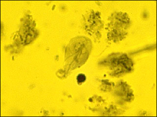 Giardia lamblia that causes giardiasis