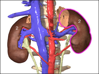 Kidney removal