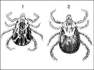 Rocky Mountain spotted fever