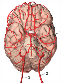 Vertebrobasilar circulatory disorder