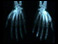 Hand X-ray