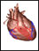 Ventricular Septal Defect