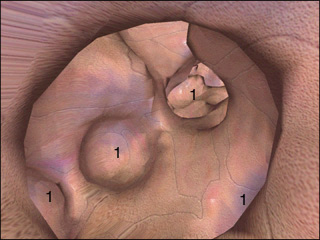 Alveoli