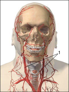 Site of carotid arteriography