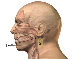 Abscess behind the pharynx