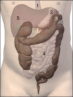 Distention of the colon's splenic flexure