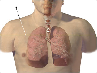 Site of lung CT