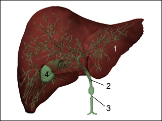 Stricture of the bile duct