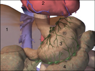 Gastrointestinal Anthrax