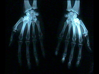 Hand X-ray