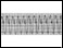 Electrocardiogram of ventricular tachycardia