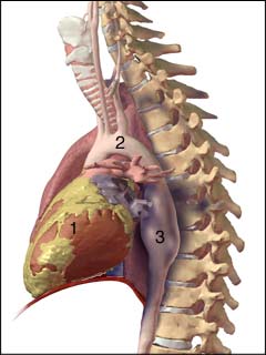 Thoracic Aortic Aneurysm